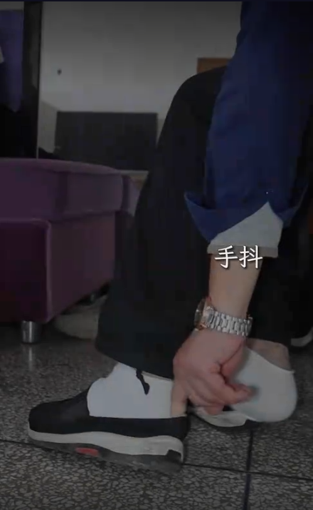 帕金森