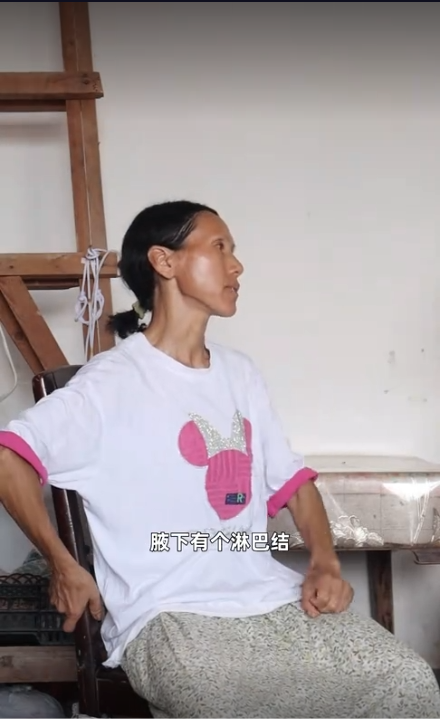 万分之一的概率